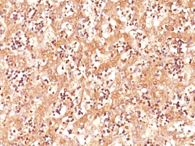 Monoclonal Antibody to AFP (Alpha Fetoprotein) (Hepatocellular/Germ Cell Tumor Marker)(Clone : C3)