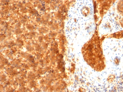 Monoclonal Antibody to AFP (Alpha Fetoprotein) (Hepatocellular/Germ Cell Tumor Marker)(Clone : SPM334)