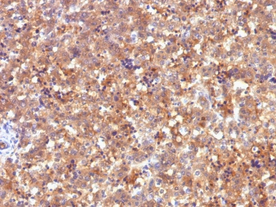 Monoclonal Antibody to AFP (Alpha Fetoprotein) (Hepatocellular/Germ Cell Tumor Marker)(Clone : C2)