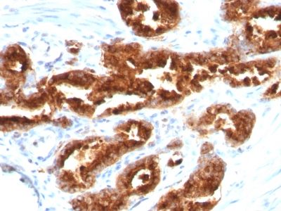 Monoclonal Antibody to TAG-72 / CA72.4 (Tumor-Associated Glycoprotein)(Clone : B72.3)