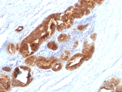 Monoclonal Antibody to TAG-72 / CA72.4 (Tumor-Associated Glycoprotein)(Clone : CC49)