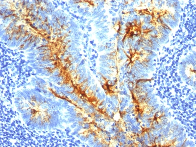 Monoclonal Antibody to TAG-72 / CA72.4 (Tumor-Associated Glycoprotein)(Clone : SPM536)