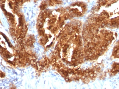 Monoclonal Antibody to TAG-72 / CA72.4 (Tumor-Associated Glycoprotein)(Clone : CA72/733)