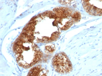 Monoclonal Antibody to TAG-72 / CA72.4 (Tumor-Associated Glycoprotein)(B72.3 + CA72/733)