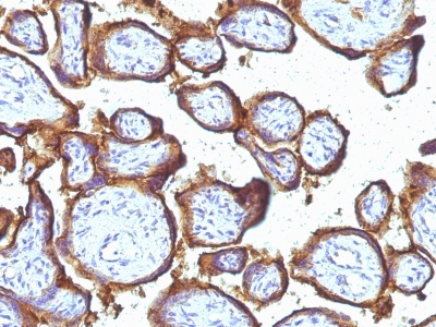 Monoclonal Antibody to EGFR (Epidermal Growth Factor Receptor)(Clone : 31G7)