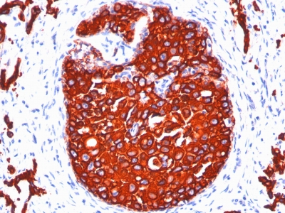 Monoclonal Antibody to Cytokeratin, pan (Epithelial Marker)(KRTL/1077 + KRTH/1076)