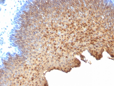 Monoclonal Antibody to Cytokeratin 10/13(Clone : SPM262)