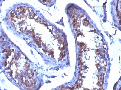 Monoclonal Antibody to Testosterone(Clone : 4E1G2)