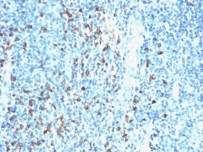 Monoclonal Antibody to Biotin (Vitamin B7 or Vitamin H)(Clone : Hyb-8)