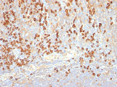 Monoclonal Antibody to Plasma Cell Marker(Clone : LIV3G11; same as 7B18)