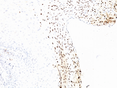 Monoclonal Antibody to HPV-16 (Human Papilloma Virus 16)(Clone : CAMVIR-1)