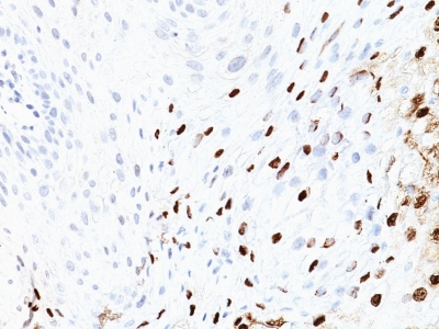 Monoclonal Antibody to HPV-16 (Human Papilloma Virus 16)(Clone : SPM405)