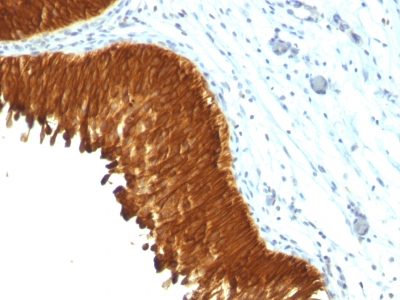 Monoclonal Antibody to Cytokeratin, Multi (Epithelial Marker)(Clone : KRT/457)(Discontinued)