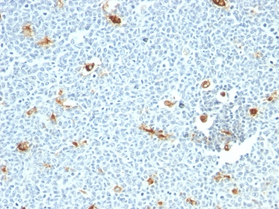 Monoclonal Antibody to Macrophage, pan (Histiocytoma & Sebocyte Marker)(Clone : LN-5)