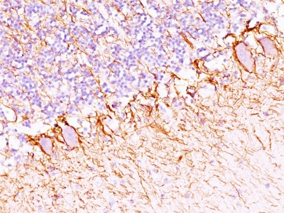 Monoclonal Antibody to Neurofilament (H+L) (Neuronal Marker)(NF421 + NFL/736)(Discontinued)