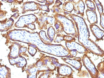 Monoclonal Antibody to EGFR (Epidermal Growth Factor Receptor)(31G7 + GFR1195)