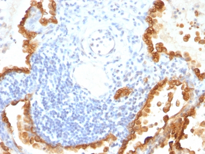 Monoclonal Antibody to Cytokeratin 8/18(KRT8/803 + KRT18/835)