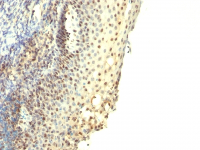 Monoclonal Antibody to Clone : IPO-38 (Proliferation Marker)(Clone : IPO-38)