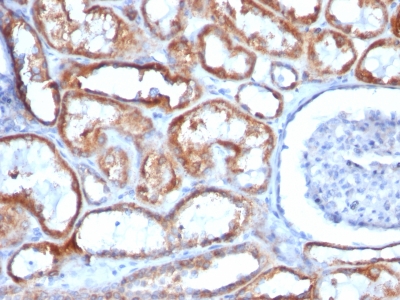 Monoclonal Antibody to Mitochondria (Marker for Human Cells, Granular RCC & Salivary Tumors)(Clone : 113-1)