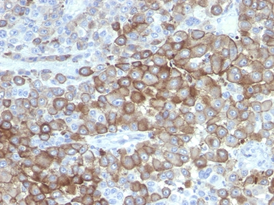 Monoclonal Antibody to Clone : PNL2 (Melanoma Associated Antigen)(Clone : PNL2)