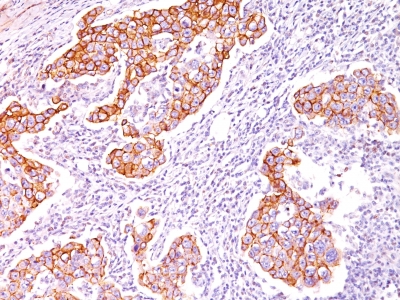 Monoclonal Antibody to Phosphotyrosine (P-Tyr)(Clone : SPM102)