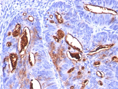 Monoclonal Antibody to CA19-9 / Sialyl Lewisa (GI Tumor Marker)(Clone : SPM588)