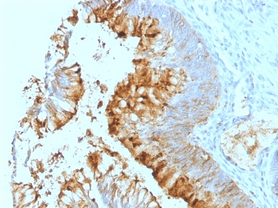 Monoclonal Antibody to Lewis A (Blood Group Antigen)(Clone : SPM279)