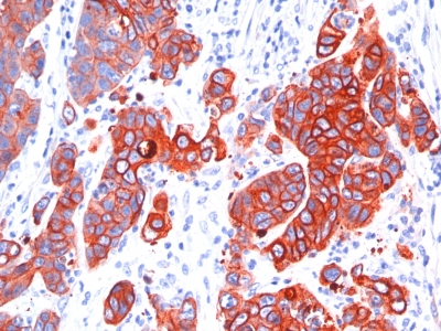 Monoclonal Antibody to Cytokeratin, Multi (Epithelial Marker)(Clone : SPM583)