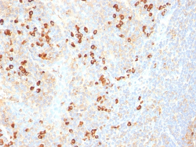 Monoclonal Antibody to Plasma Cell Marker(Clone : SPM310)