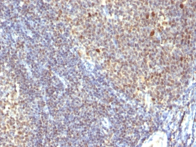 Monoclonal Antibody to IPO-38 (Proliferation Marker)(Clone : SPM260)