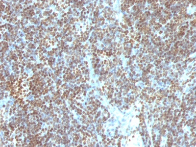 Monoclonal Antibody to Double Stranded DNA (dsDNA) (Nuclear Marker)(Clone : SPM603)