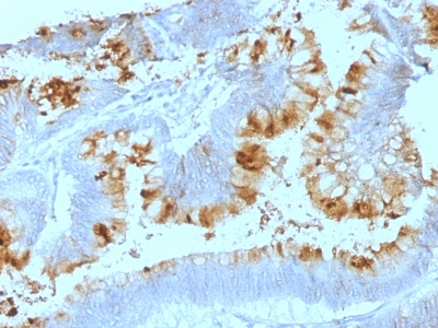 Monoclonal Antibody to Lewis A (Blood Group Antigen)(Clone : SPM522)