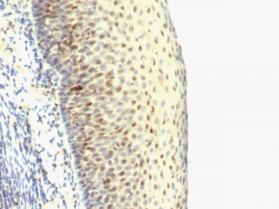 Monoclonal Antibody to IPO-38 (Proliferation Marker)(Clone : SPM515)