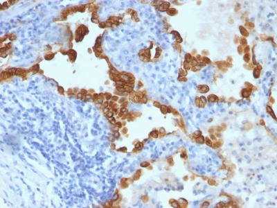 Monoclonal Antibody to Cytokeratin 8/18(Clone : B22.1/B23.1)