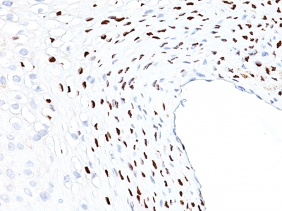 Monoclonal Antibody to HPV-16 (Human Papilloma Virus 16)(Clone : HPV16L1/1058)