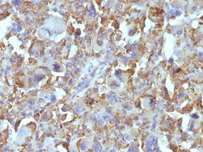 Monoclonal Antibody to Macrophage & Histiocytoma Marker(Clone : D11)