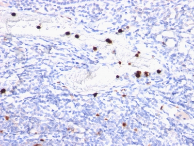 Monoclonal Antibody to Myeloid Cell Marker (Macrophage / Granulocyte Marker)(Clone : BM-2)