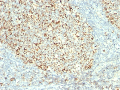 Monoclonal Antibody to Mitochondria (Marker for Human Cells)(Clone : MTC02)