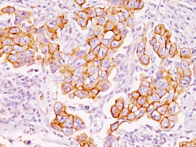 Monoclonal Antibody to Phosphotyrosine (P-Tyr)(Clone : PY793)