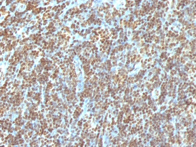 Monoclonal Antibody to Double Stranded DNA (dsDNA) (Nuclear Marker)(Clone : AE-2)