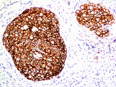 Monoclonal Antibody to HER-2 / c-erbB-2 / neu / CD340(Clone : ERB2/776)