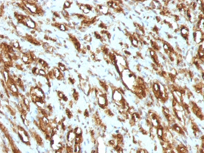 Monoclonal Antibody to Actin, Muscle Specific (Muscle Cell Marker)(Clone : MSA/953)