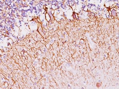 Monoclonal Antibody to Neurofilament (H+L) (Neuronal Marker)(Clone : SPM145)