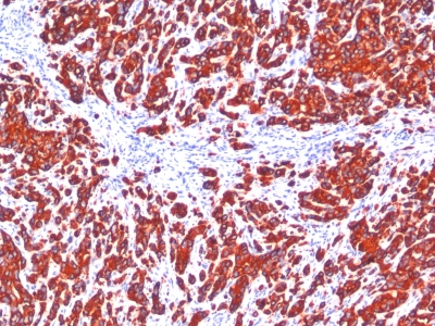 Monoclonal Antibody to Cytokeratin, pan (Epithelial Marker)(SPM115 + SPM116)