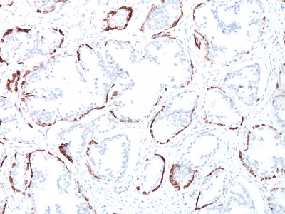 Monoclonal Antibody to Cytokeratin, Basic (Type II or HMW) (Epithelial Marker)(Clone : 34BE12)