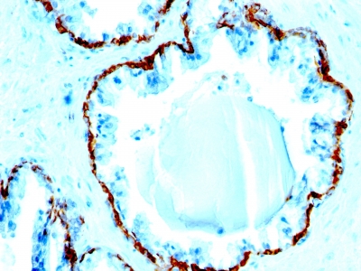 Monoclonal Antibody to Cytokeratin, Basic (Type II or HMW) (Epithelial Marker)(Clone : SPM591)