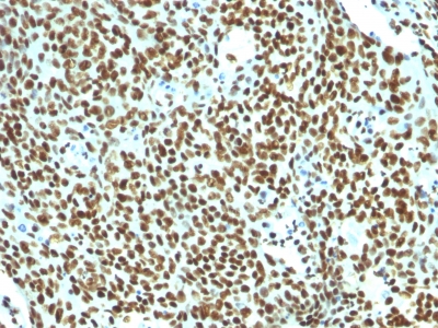 Monoclonal Antibody to Nuclear Antigen (Pan-Nuclear Marker)(Clone : NM106)