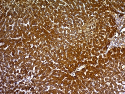 Monoclonal Antibody to HepPar-1 (Hepatocellular Marker)(Clone : HepPar1)