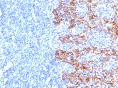 Monoclonal Antibody to Cytokeratin, Acidic (Type I or LMW) (Epithelial Marker)(Clone : SPM115)