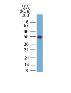 Monoclonal Antibody to Ep-CAM / CD326 (Rat) (Epithelial Marker)(Clone : SPM534)